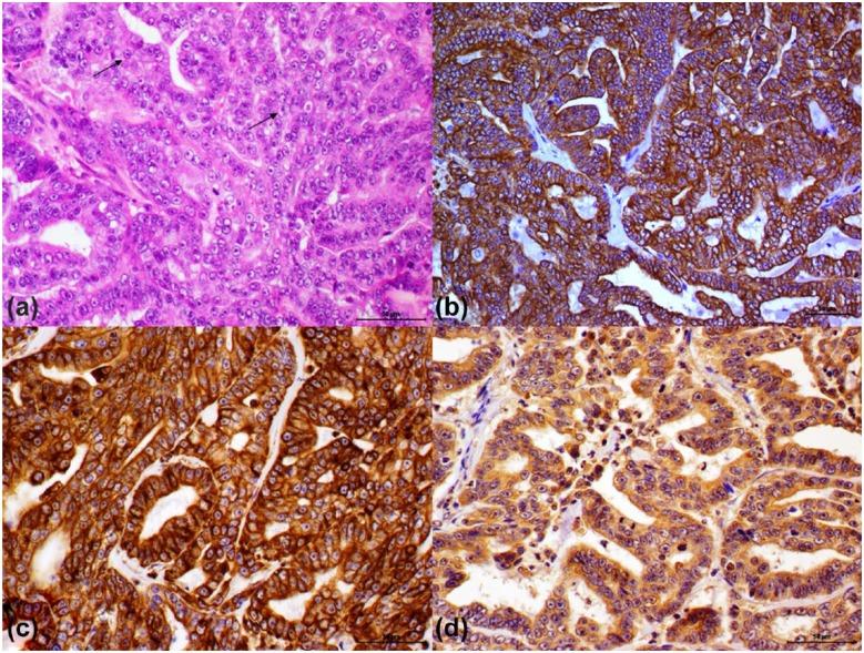 https://cdn.ncbi.nlm.nih.gov/pmc/blobs/3973/5361992/96934eef5908/10.1177_2055116915608202-fig1.jpg