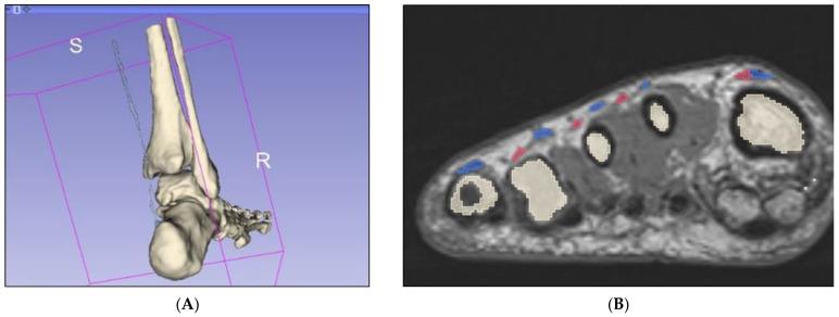 https://cdn.ncbi.nlm.nih.gov/pmc/blobs/3974/9608320/94c2a7ea0b07/micromachines-13-01701-g006.jpg