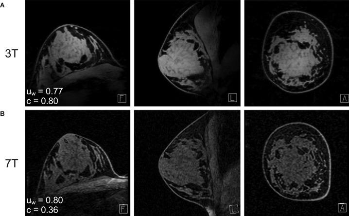 https://cdn.ncbi.nlm.nih.gov/pmc/blobs/3977/7235971/12d6d66a2a8b/fmed-07-00175-g0001.jpg