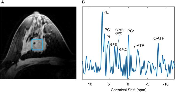 https://cdn.ncbi.nlm.nih.gov/pmc/blobs/3977/7235971/59a67dc36b9a/fmed-07-00175-g0004.jpg
