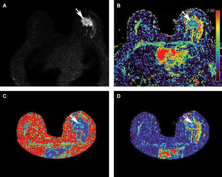 https://cdn.ncbi.nlm.nih.gov/pmc/blobs/3977/7235971/9533e86f4d34/fmed-07-00175-g0003.jpg