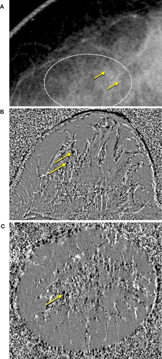 https://cdn.ncbi.nlm.nih.gov/pmc/blobs/3977/7235971/aa60d518fde9/fmed-07-00175-g0006.jpg