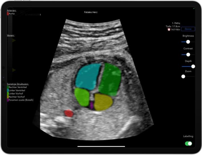 https://cdn.ncbi.nlm.nih.gov/pmc/blobs/3985/8782791/8895100c4b01/404_2021_6102_Fig3_HTML.jpg