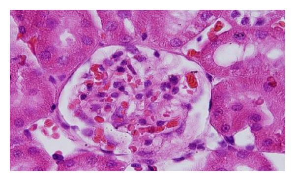 https://cdn.ncbi.nlm.nih.gov/pmc/blobs/3988/3730147/1398b1553de4/BMRI2013-353695.011.jpg