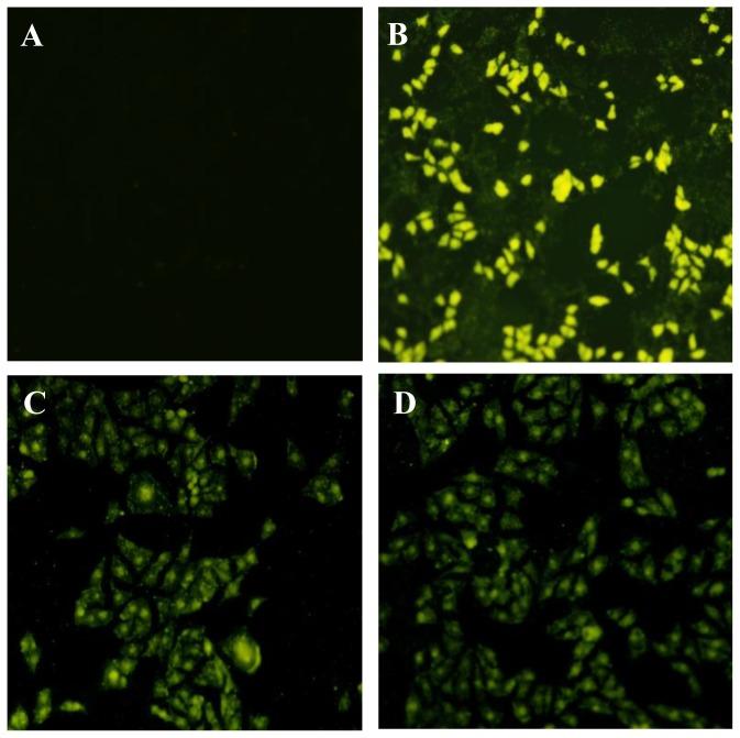 https://cdn.ncbi.nlm.nih.gov/pmc/blobs/398b/3382812/d9ec006d9e2c/ijms-13-05715f2.jpg