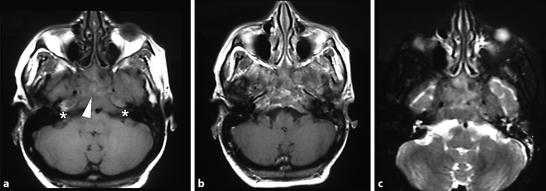 https://cdn.ncbi.nlm.nih.gov/pmc/blobs/398d/3072192/db63ea651dbb/crn0003-0045-f01.jpg