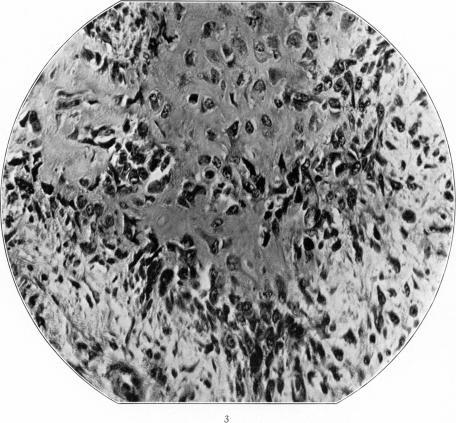 https://cdn.ncbi.nlm.nih.gov/pmc/blobs/3994/2062775/d530a376400b/amjpathol00718-0140-c.jpg