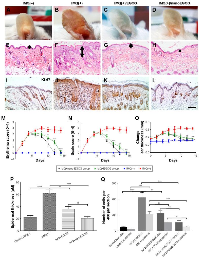 https://cdn.ncbi.nlm.nih.gov/pmc/blobs/3996/9964857/a7bf870ace38/pharmaceutics-15-00657-g004.jpg