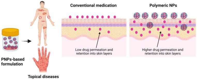 https://cdn.ncbi.nlm.nih.gov/pmc/blobs/3996/9964857/d9629ae6d378/pharmaceutics-15-00657-g003.jpg