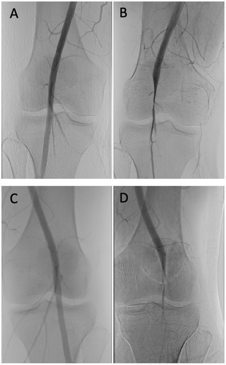 https://cdn.ncbi.nlm.nih.gov/pmc/blobs/3998/11353322/a9c39ff51630/diagnostics-14-01825-g003.jpg