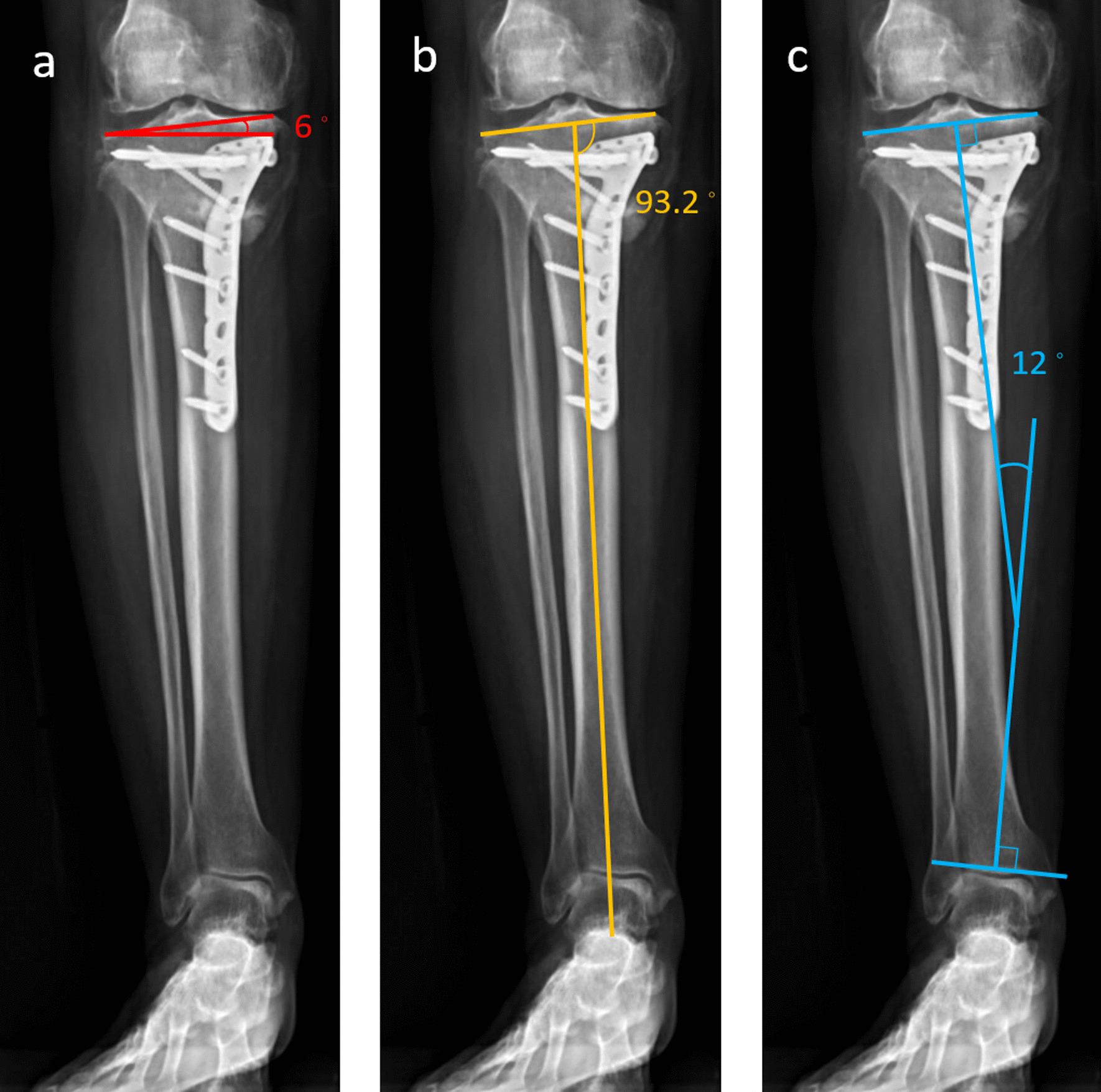 https://cdn.ncbi.nlm.nih.gov/pmc/blobs/3998/8818150/b2a620f2044b/13018_2022_2976_Fig3_HTML.jpg