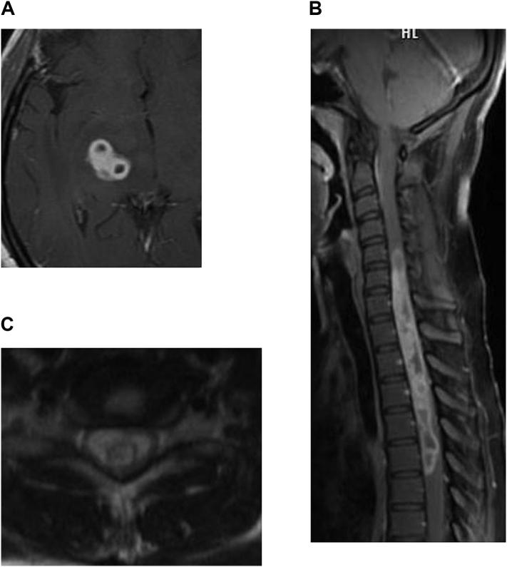 https://cdn.ncbi.nlm.nih.gov/pmc/blobs/39a1/7875821/3595029fbbc4/gr5.jpg
