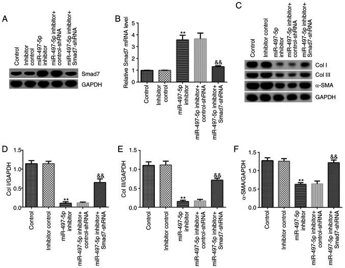 https://cdn.ncbi.nlm.nih.gov/pmc/blobs/39a4/7918061/3d4bd50cec0e/etm-21-04-09815-g04.jpg