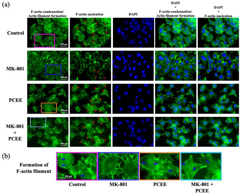 https://cdn.ncbi.nlm.nih.gov/pmc/blobs/39af/12109770/5d4ea61ae100/cimb-47-00312-g010.jpg
