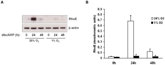 https://cdn.ncbi.nlm.nih.gov/pmc/blobs/39af/3260294/cbfb5e618874/pone.0030453.g005.jpg