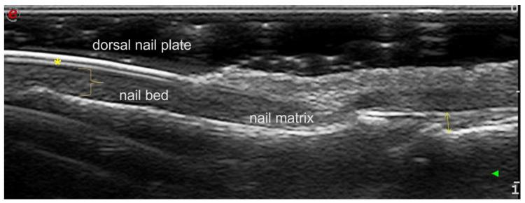 https://cdn.ncbi.nlm.nih.gov/pmc/blobs/39b3/10341279/b25a79a57f09/diagnostics-13-02236-g001.jpg