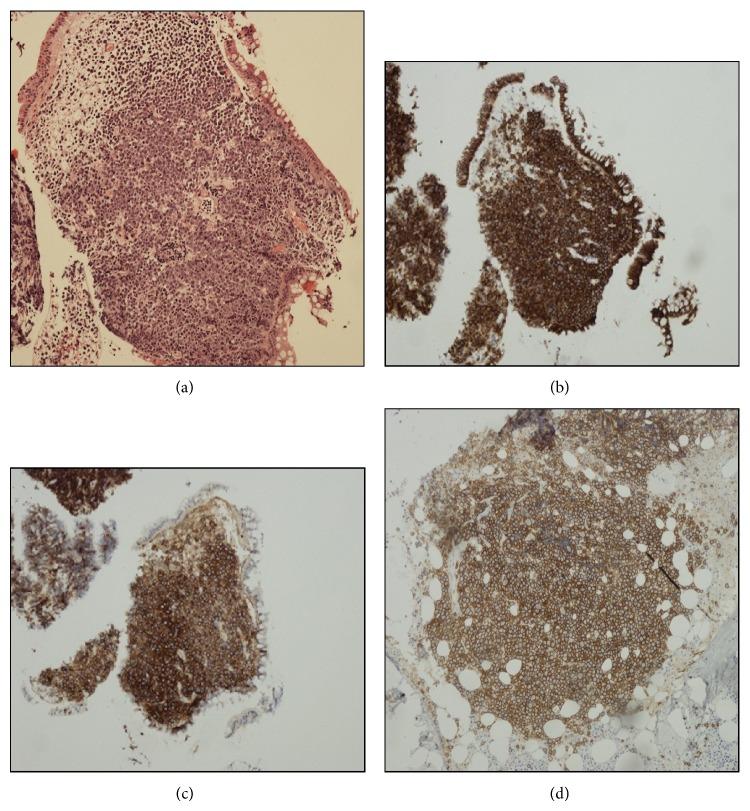 https://cdn.ncbi.nlm.nih.gov/pmc/blobs/39bb/4415489/ce5bd433bd8c/CRIHEM2015-818715.003.jpg