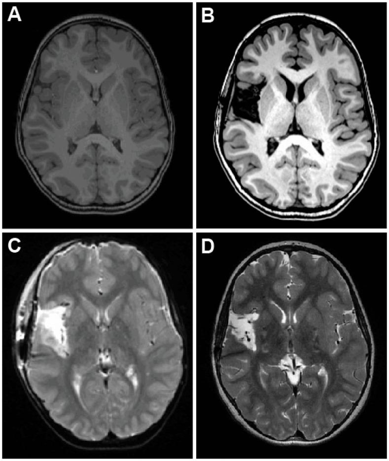 https://cdn.ncbi.nlm.nih.gov/pmc/blobs/39be/11853241/72e728f575fe/brainsci-15-00177-g006.jpg