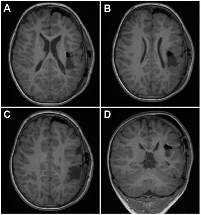 https://cdn.ncbi.nlm.nih.gov/pmc/blobs/39be/11853241/a5334a2fc8eb/brainsci-15-00177-g005.jpg