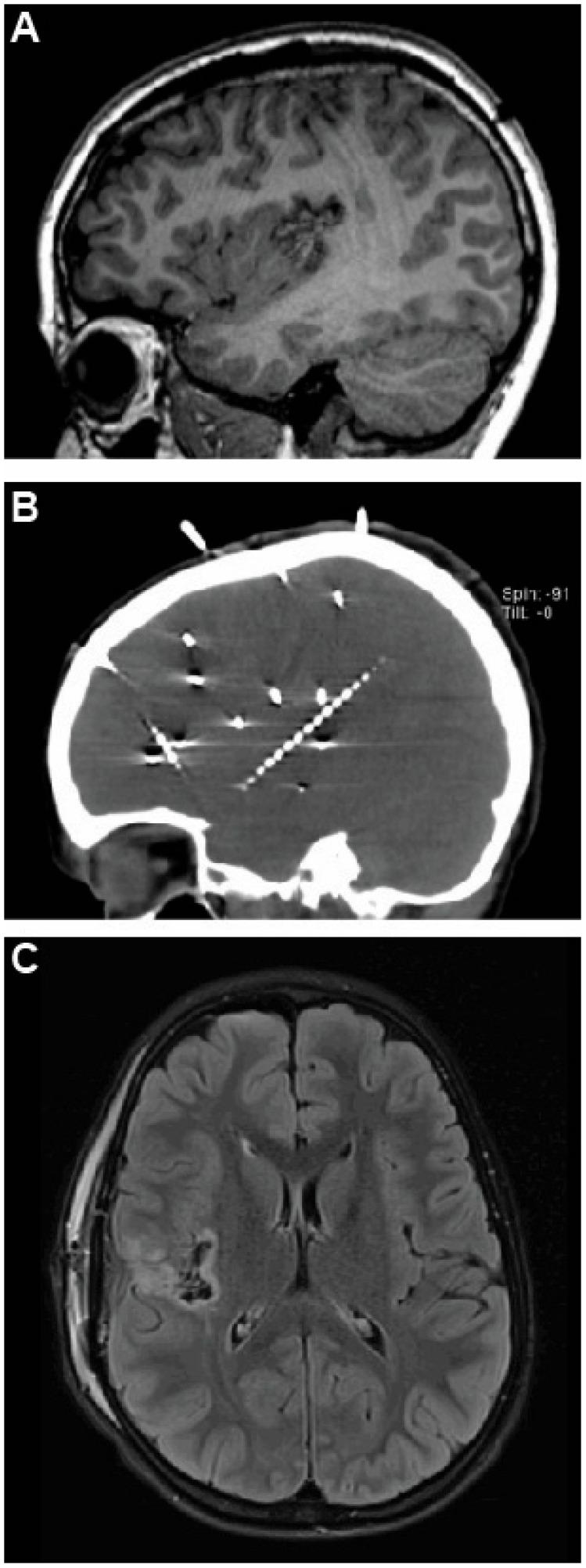 https://cdn.ncbi.nlm.nih.gov/pmc/blobs/39be/11853241/c5d6e3cddf6b/brainsci-15-00177-g002.jpg