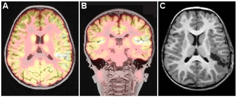 https://cdn.ncbi.nlm.nih.gov/pmc/blobs/39be/11853241/c9c0f5f66b9b/brainsci-15-00177-g003.jpg