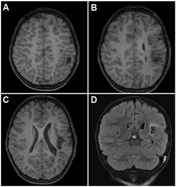https://cdn.ncbi.nlm.nih.gov/pmc/blobs/39be/11853241/cdcb4ac06f9b/brainsci-15-00177-g004.jpg
