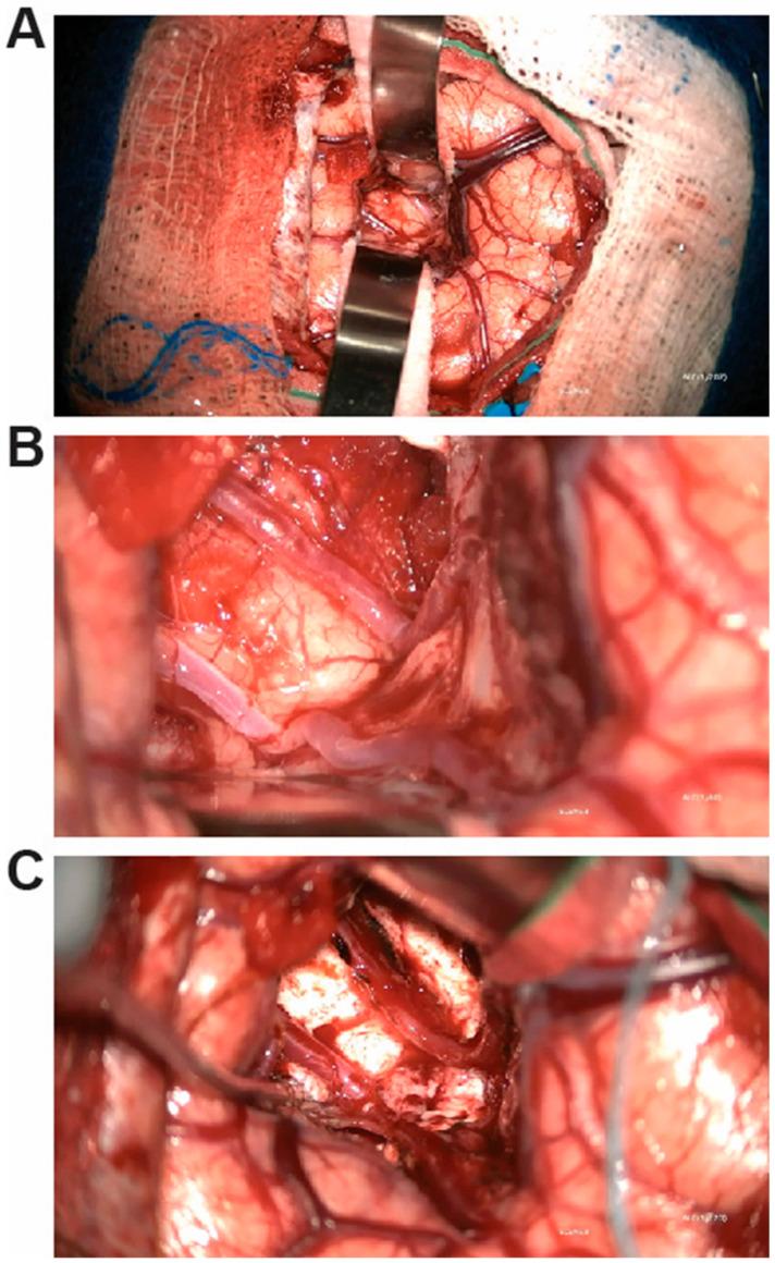 https://cdn.ncbi.nlm.nih.gov/pmc/blobs/39be/11853241/e7979eda89b3/brainsci-15-00177-g001.jpg