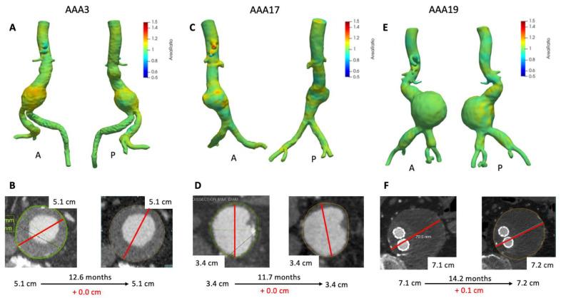 https://cdn.ncbi.nlm.nih.gov/pmc/blobs/39cf/8162544/93ed9a82fb77/tomography-07-00017-g003.jpg