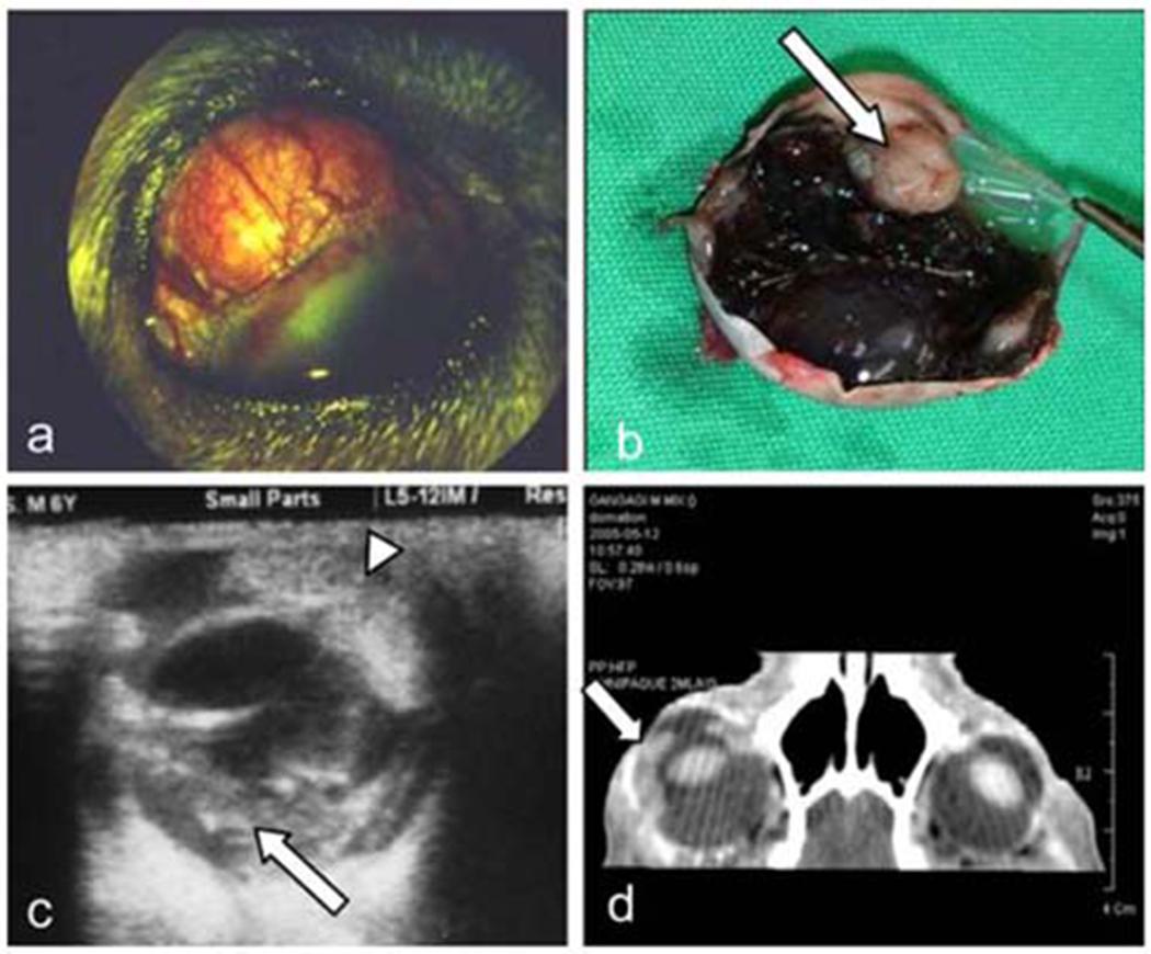 https://cdn.ncbi.nlm.nih.gov/pmc/blobs/39d7/8959478/b50659b69cd1/nihms-1749790-f0001.jpg