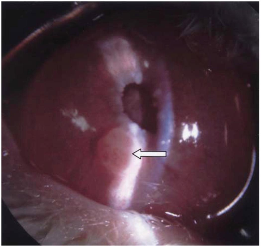 https://cdn.ncbi.nlm.nih.gov/pmc/blobs/39d7/8959478/f868f610d143/nihms-1749790-f0004.jpg