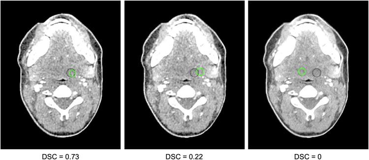 https://cdn.ncbi.nlm.nih.gov/pmc/blobs/39da/11269546/94ca95313e92/41747_2024_486_Fig3_HTML.jpg