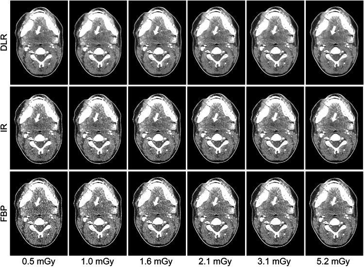 https://cdn.ncbi.nlm.nih.gov/pmc/blobs/39da/11269546/ab6454355535/41747_2024_486_Fig2_HTML.jpg