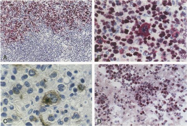https://cdn.ncbi.nlm.nih.gov/pmc/blobs/39e2/1887058/d5fd0a54317d/amjpathol00070-0103-a.jpg