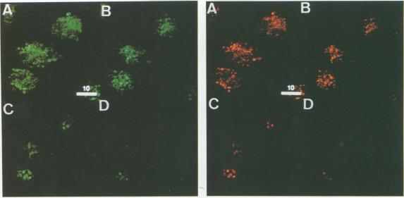 https://cdn.ncbi.nlm.nih.gov/pmc/blobs/39ea/186077/50e8a6cd2862/iai00001-0154-a.jpg