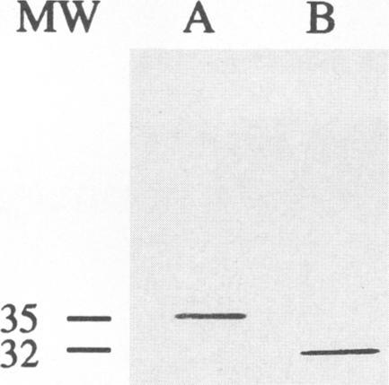 https://cdn.ncbi.nlm.nih.gov/pmc/blobs/39ea/186077/9082807ba15e/iai00001-0154-b.jpg