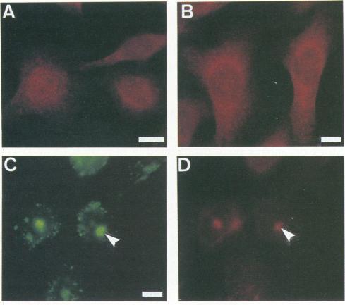 https://cdn.ncbi.nlm.nih.gov/pmc/blobs/39ea/186077/b7e964866c9e/iai00001-0150-a.jpg