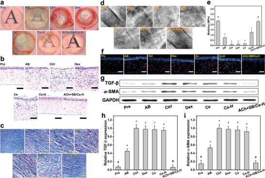 https://cdn.ncbi.nlm.nih.gov/pmc/blobs/39ec/10502830/a20a0fd6eb63/ADVS-10-2302174-g005.jpg