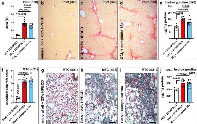 https://cdn.ncbi.nlm.nih.gov/pmc/blobs/39ef/11072816/c965f1269e7c/18_2022_4317_Fig2_HTML.jpg
