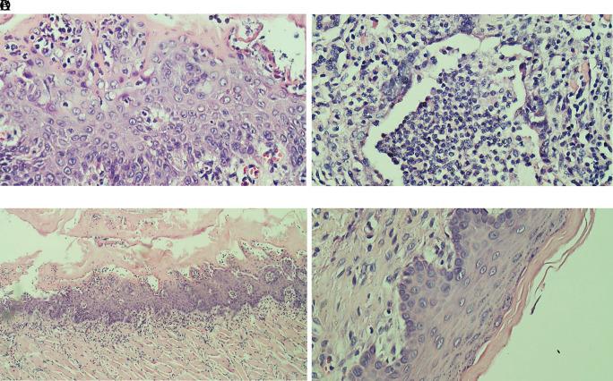 https://cdn.ncbi.nlm.nih.gov/pmc/blobs/39fd/12187084/2ae55efd1ac1/f1000research-11-183223-g0001.jpg