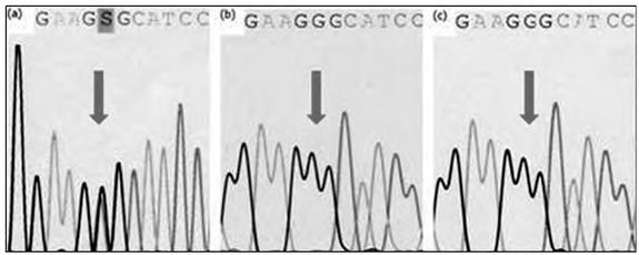 https://cdn.ncbi.nlm.nih.gov/pmc/blobs/3a01/7474213/1d4fefffb380/bjmg-23-095-g003.jpg