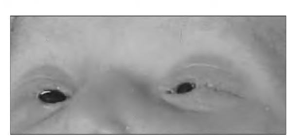 https://cdn.ncbi.nlm.nih.gov/pmc/blobs/3a01/7474213/cabf5420b304/bjmg-23-095-g001.jpg