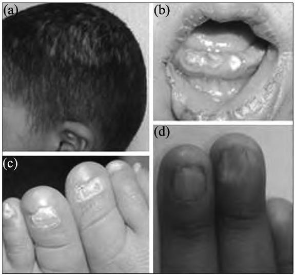 https://cdn.ncbi.nlm.nih.gov/pmc/blobs/3a01/7474213/d94b2f15cb88/bjmg-23-095-g002.jpg