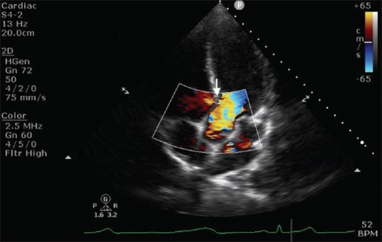 https://cdn.ncbi.nlm.nih.gov/pmc/blobs/3a03/10691562/09591b9d0529/ACA-26-367-g004.jpg