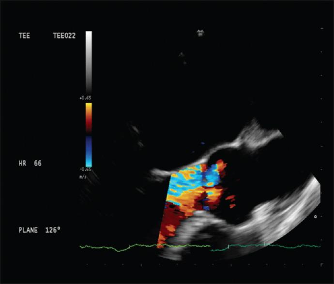 https://cdn.ncbi.nlm.nih.gov/pmc/blobs/3a03/10691562/c470a6a68df6/ACA-26-367-g005.jpg