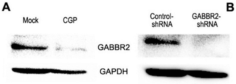 https://cdn.ncbi.nlm.nih.gov/pmc/blobs/3a09/10530579/0423cd1538fa/ijms-24-13733-g003.jpg