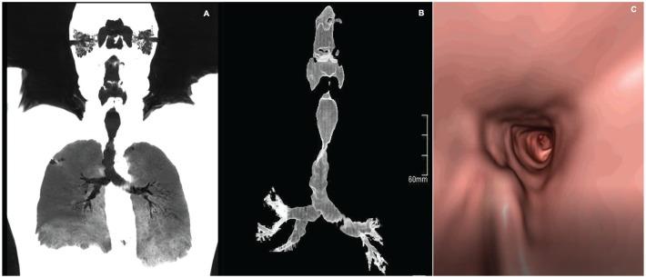 https://cdn.ncbi.nlm.nih.gov/pmc/blobs/3a0b/7238787/185a7a6a9ee6/10.1177_2324709620921609-fig3.jpg