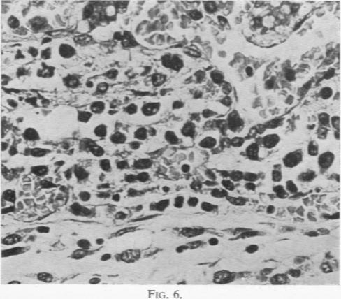 https://cdn.ncbi.nlm.nih.gov/pmc/blobs/3a11/1988473/7047f6167c81/archdisch01412-0083-b.jpg