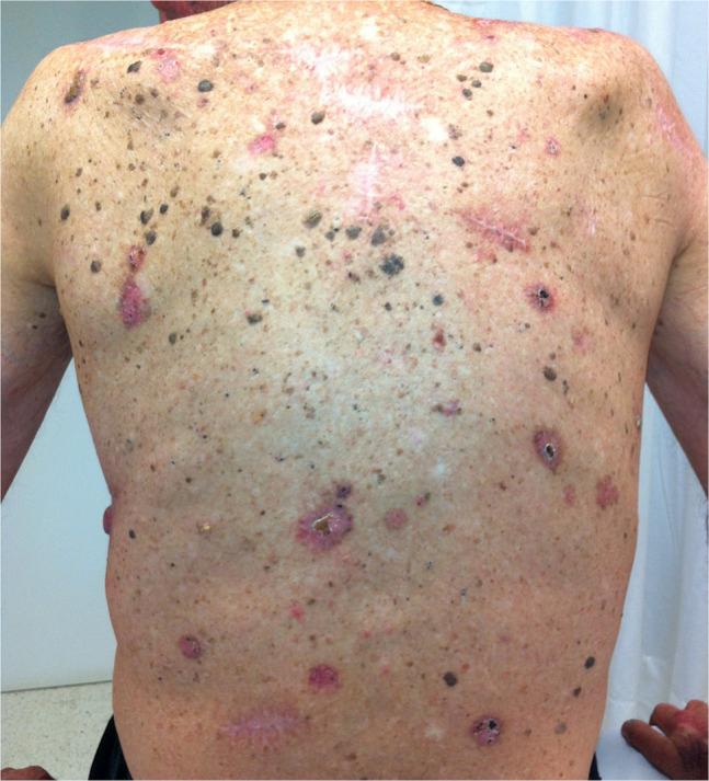 https://cdn.ncbi.nlm.nih.gov/pmc/blobs/3a12/7319751/5cd5262e8702/dp1003a66g002.jpg