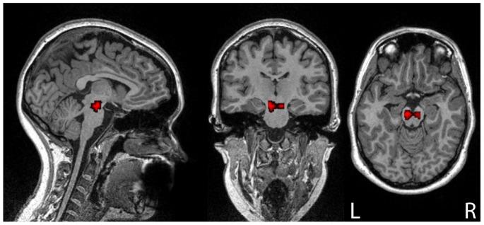 https://cdn.ncbi.nlm.nih.gov/pmc/blobs/3a15/3909040/64457bd3e444/pone.0087109.g001.jpg