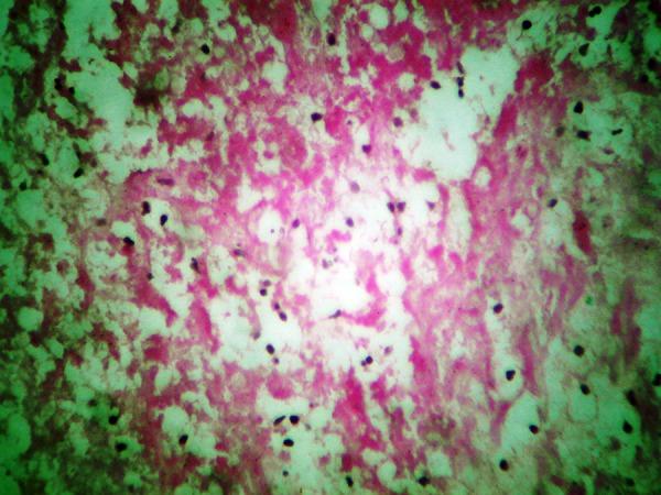 https://cdn.ncbi.nlm.nih.gov/pmc/blobs/3a16/3871753/38ff6509ffa7/ircmj-15-614-g003.jpg